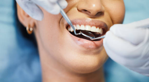 Best Emergency Treatment for Toothache in Boiling Springs, PA